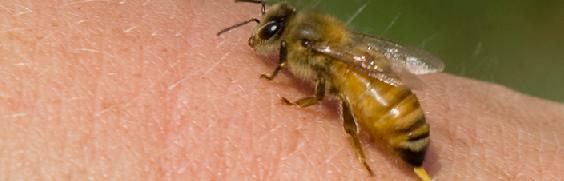 Insect Bites